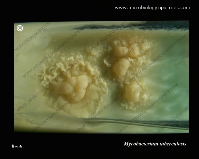 mycobacterium tuberculosis colony close-up